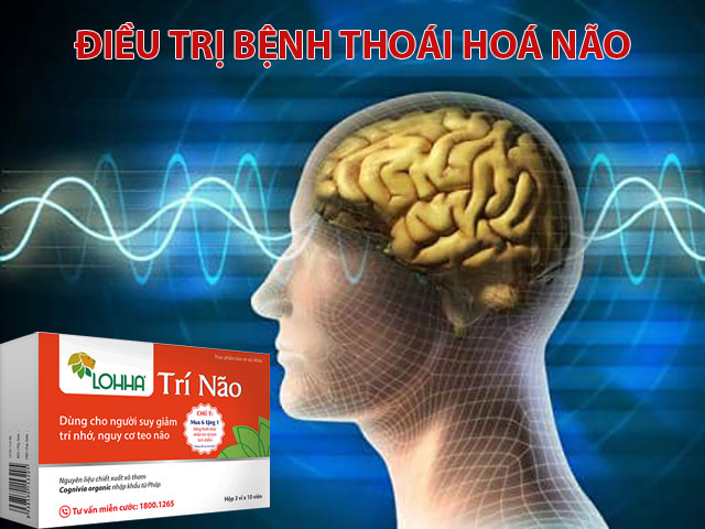 Cách điều trị bệnh thoái hoá não