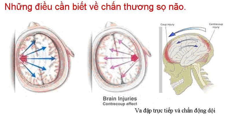 Tổng quan về chấn thương sọ não 1