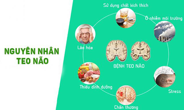 Nguyên nhân teo não & Những nguy cơ tiềm ẩn của bệnh